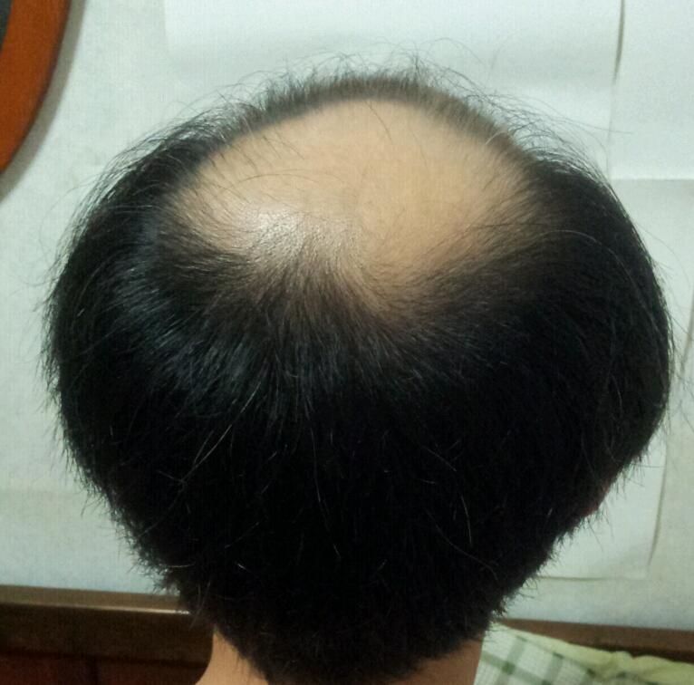 뒷머리.jpg