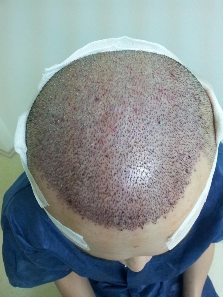 2011-12-04 17.30.16.jpg