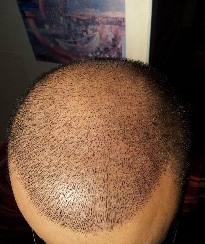 2011-12-15 10.28.42.jpg