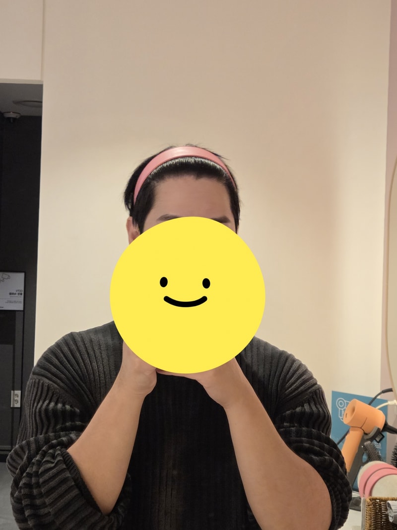뉴헤어 6개월차 비절개 모발이식 후기 입니다(1600모낭)