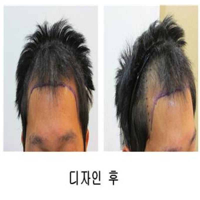 디자인 후.jpg