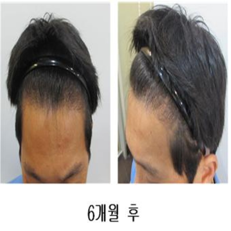 6개월 후.jpg