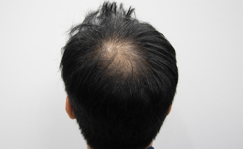수술전.jpg