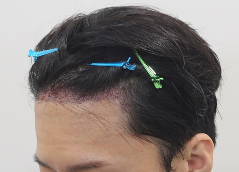 진 후2.jpg