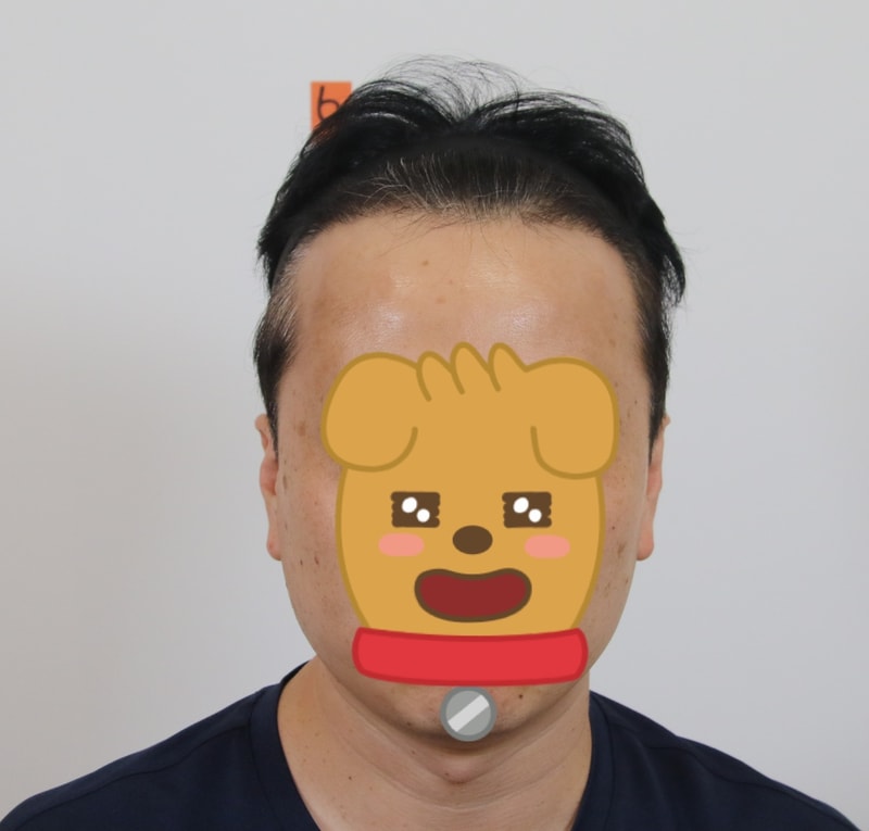 수술후 멀리.jpg