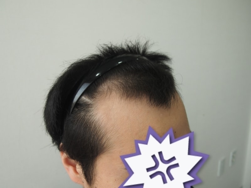 전ㅡ우.png