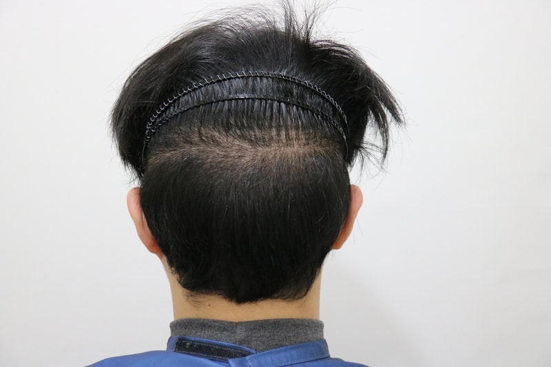 2주후 뒷모습2.jpg