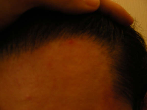 combed back_right 2.jpg