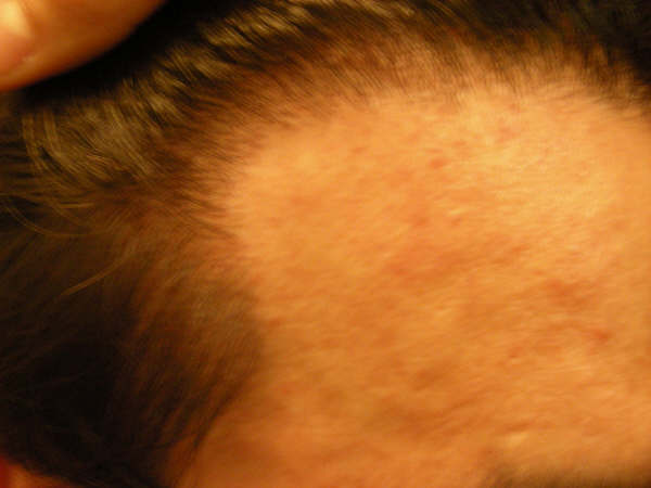 combed back_left.jpg