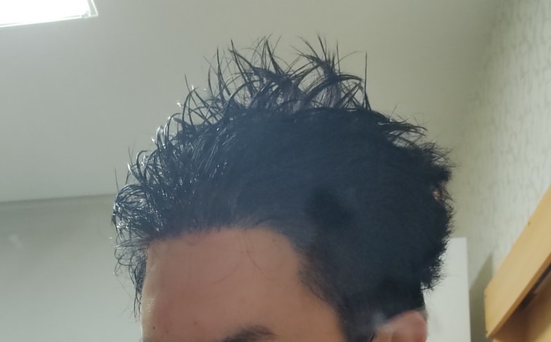 1000모 리터치 당일 3일 경과 사진입니다.