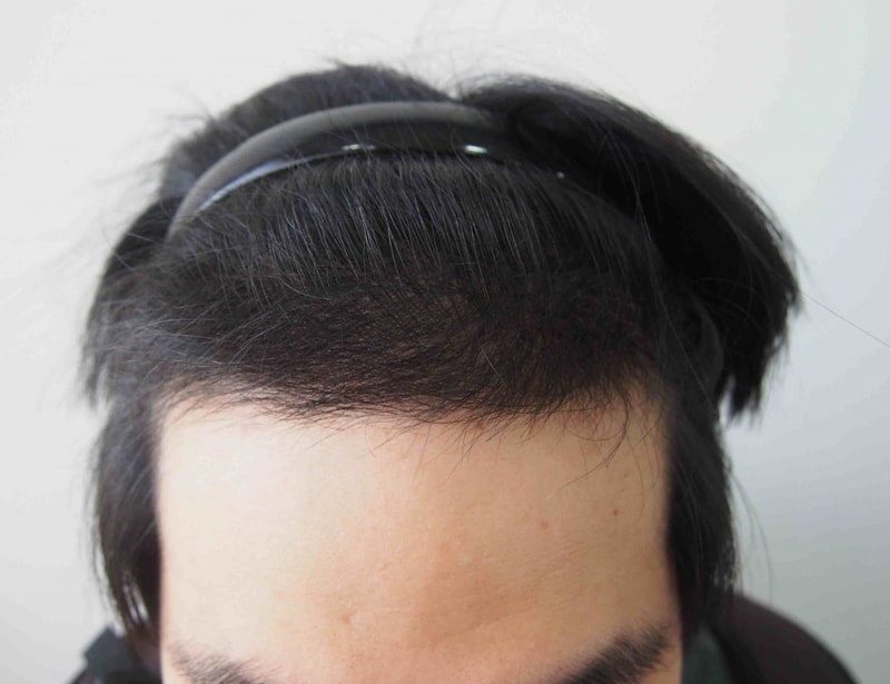 4개월 1.JPG