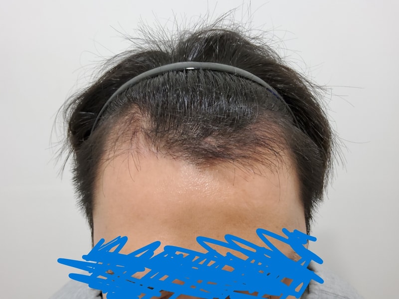 90일차병원진료2.jpg