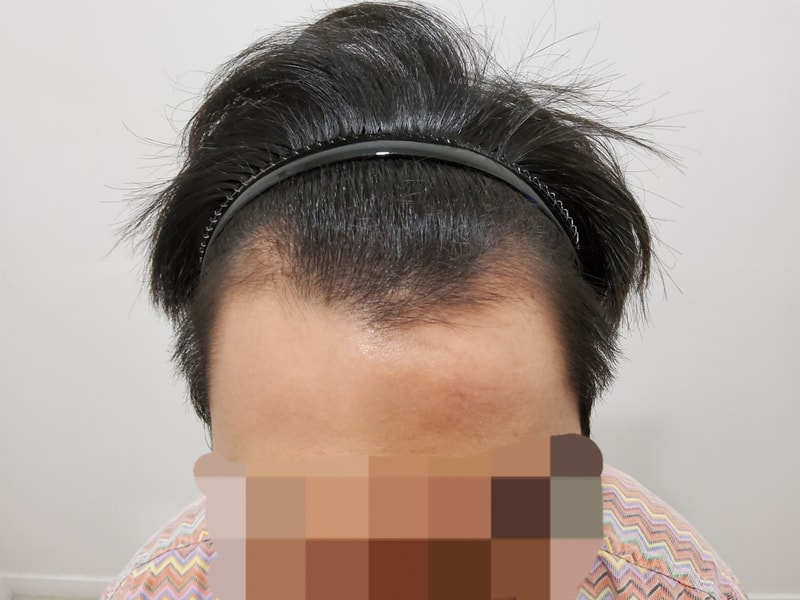 수술 전-1.jpg