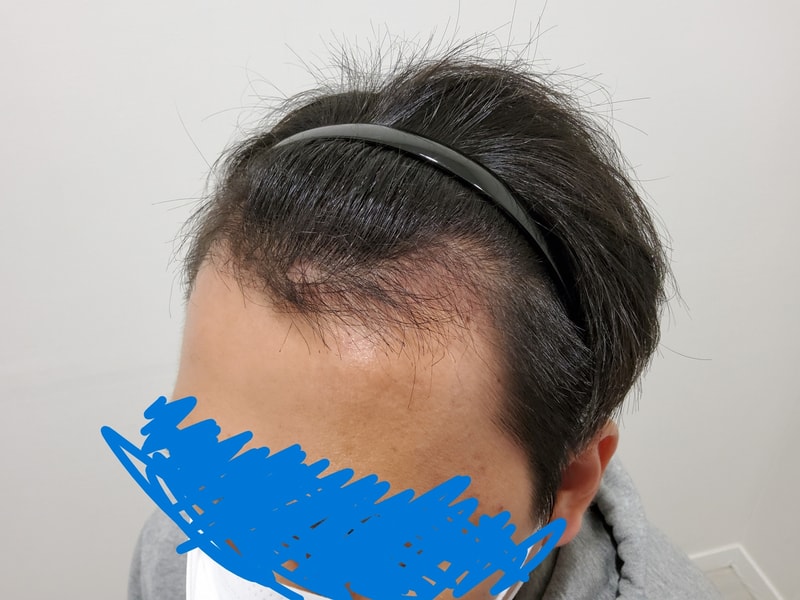 90일차병원진료3.jpg