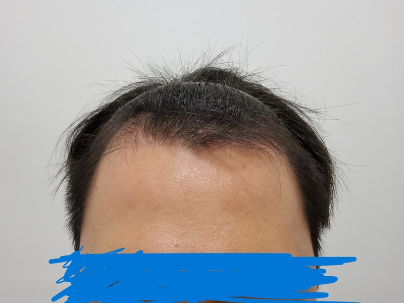 90일차병원진료1.jpg