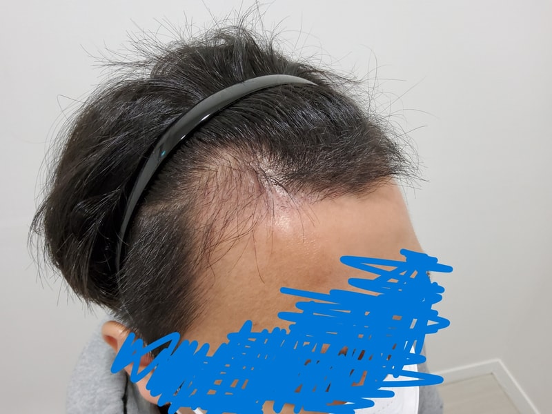 90일차병원진료4.jpg