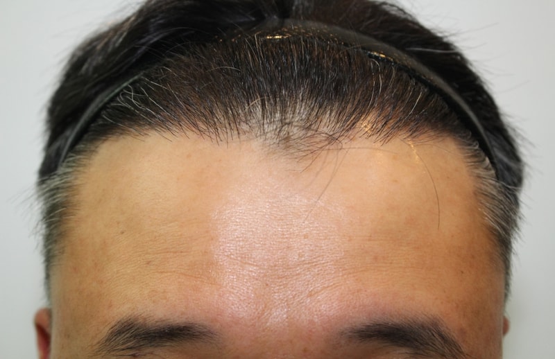 수술후6.jpg