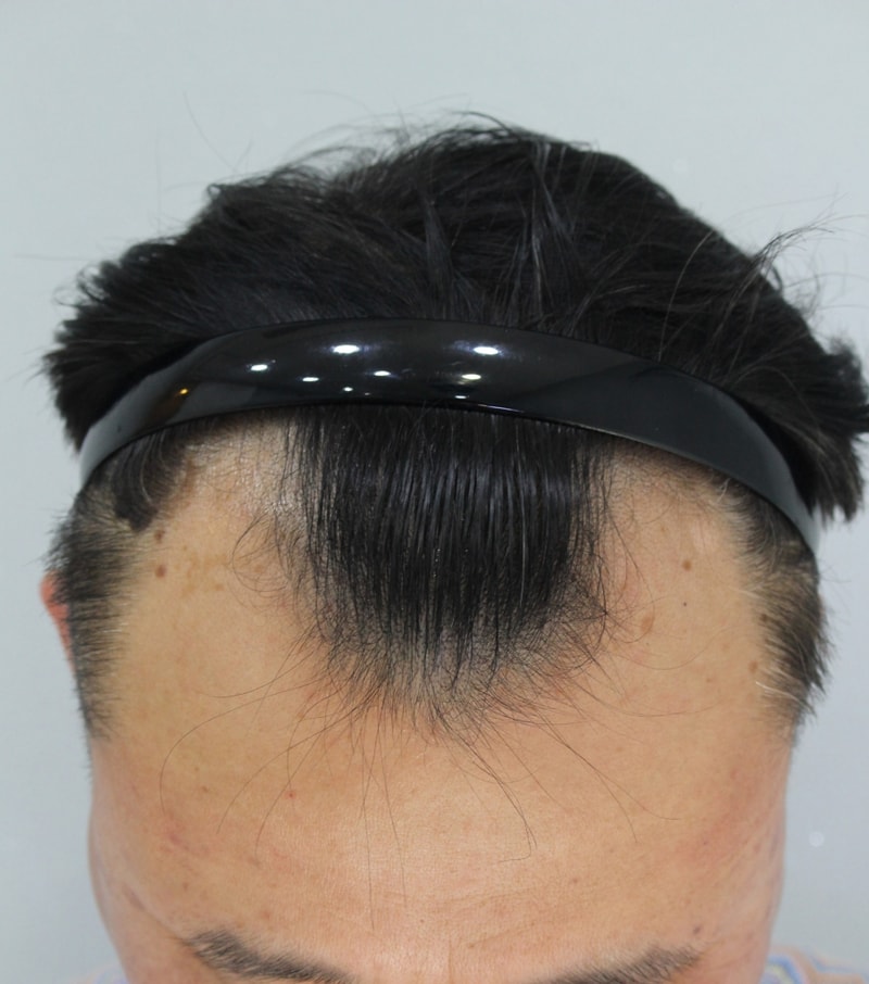수술전1.jpg