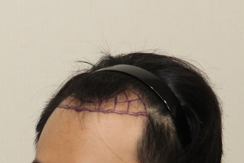 후디자인 2.jpg