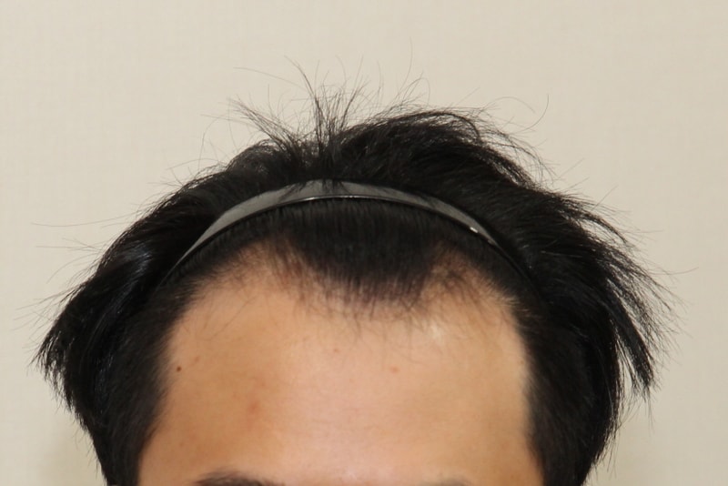 전노디자인 2.jpg