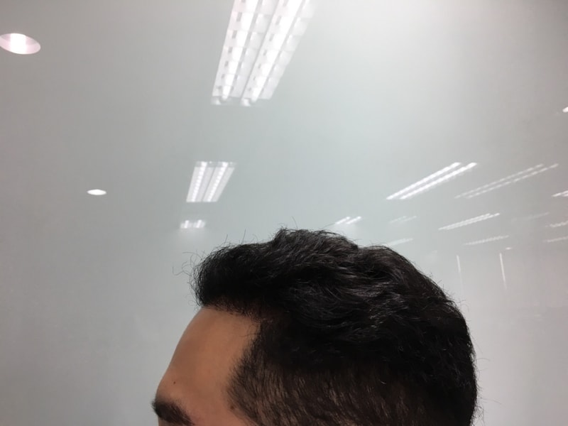 왼쪽.jpg