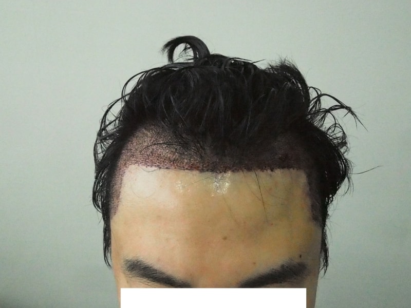 대다모 올릴파일3-후.jpg