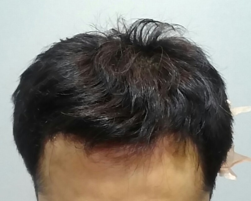 20180103_175012~2.jpg
