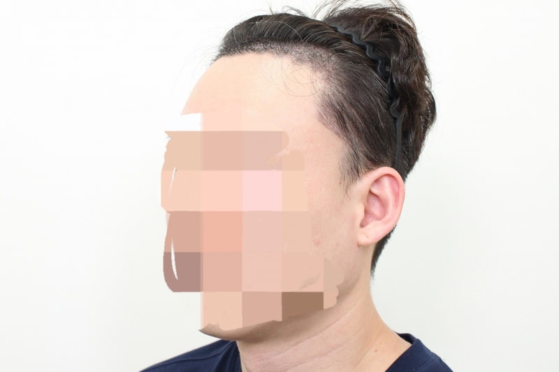 후 2.jpg