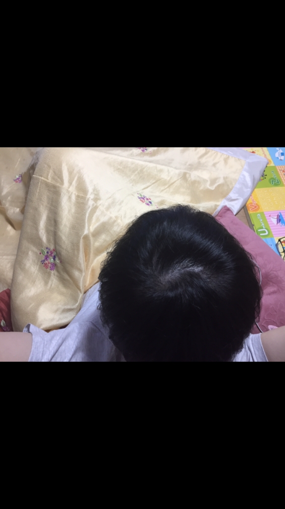 A7CC7FBE-A555-46B7-B3B4-38CA66F0503D.png