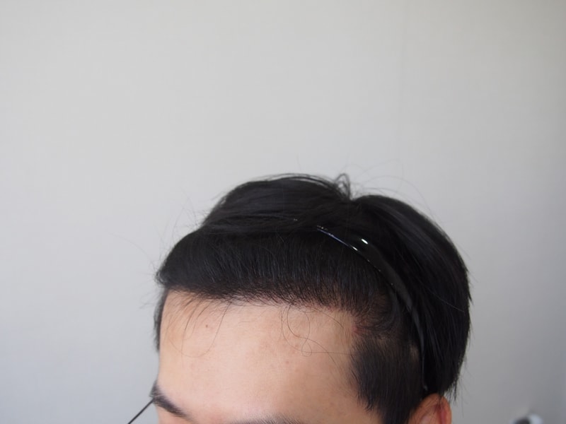 좌측.JPG