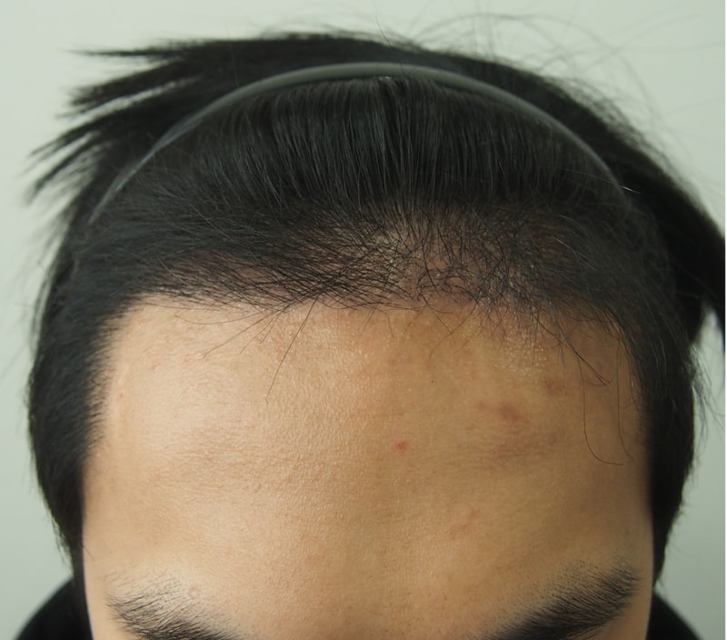 4개월차 정면.jpg