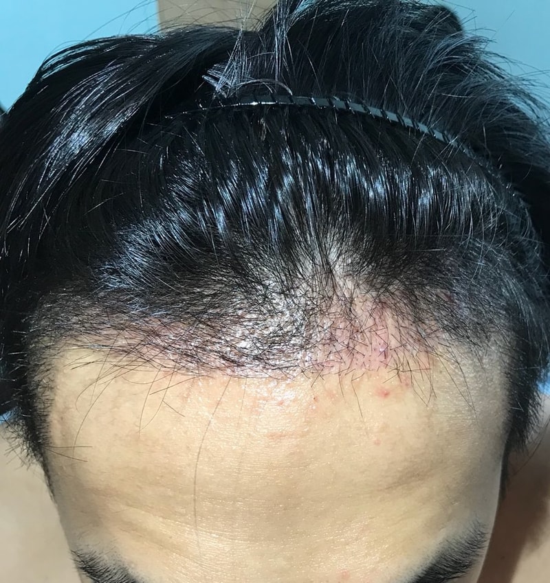 1개월차 정면.jpg