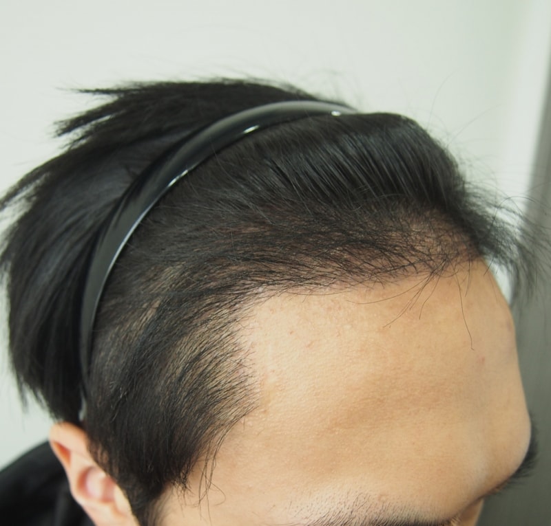 4개월차 오른.jpg