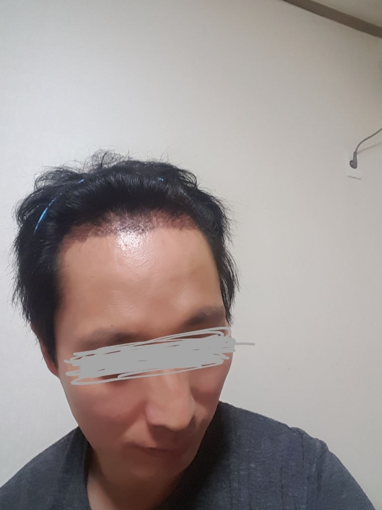 20170910_224017.jpg