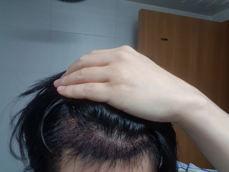 후우.jpg