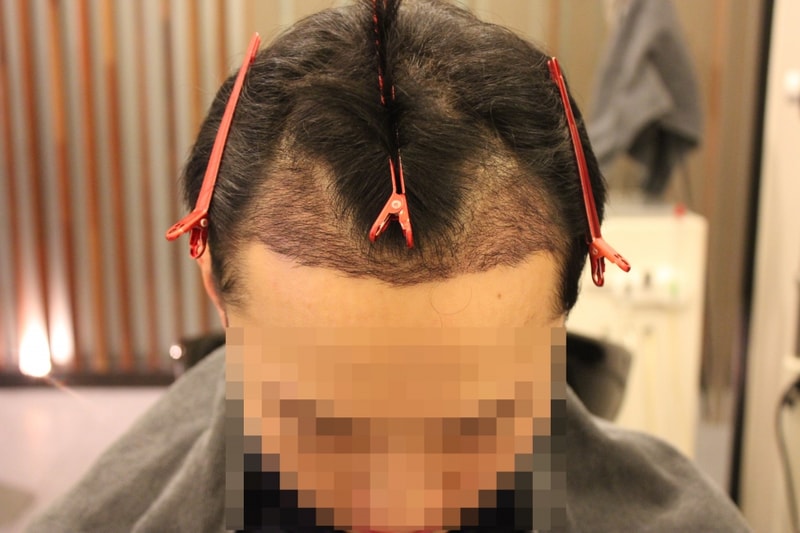 18-910214임경래__fue경과#22 (7)2322.JPG
