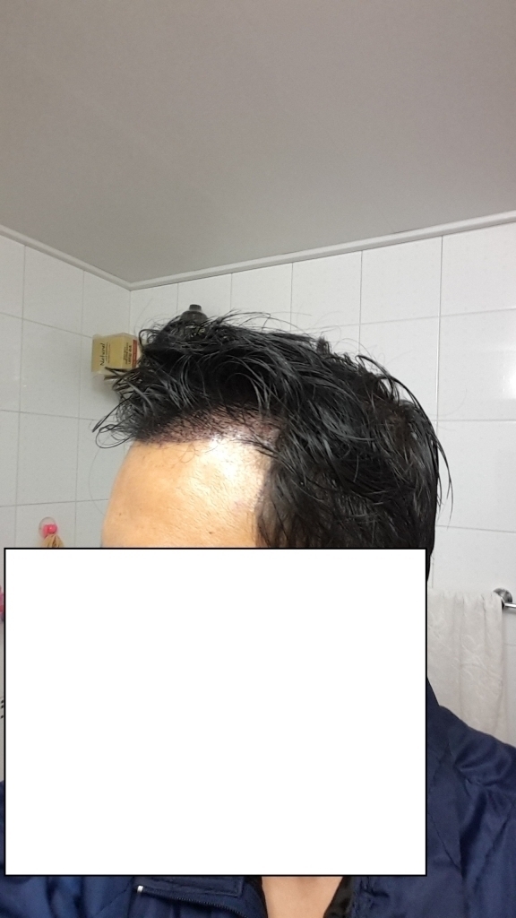 20170306_200906.jpg