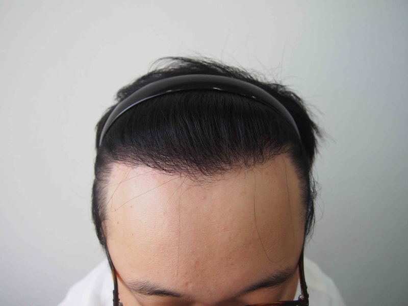 크기변환_10개월 머리 올리고.JPG