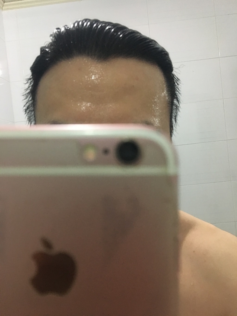 뉴헤어 약 300일 후기 올립니다.