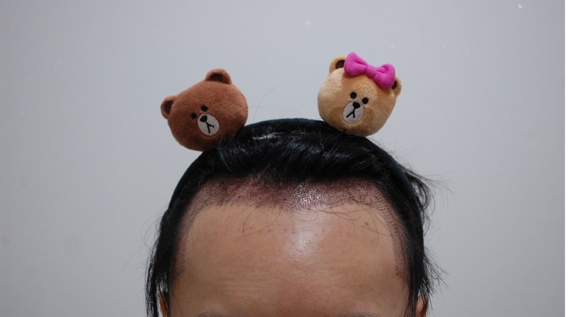 수술후.JPG