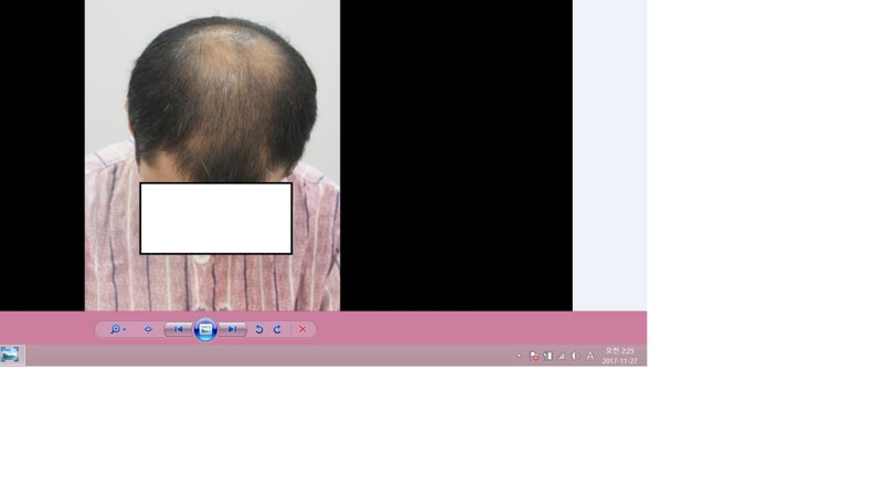 수술전33.png