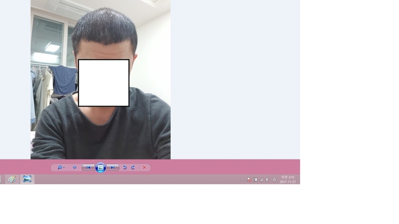 수술후 4-4.png