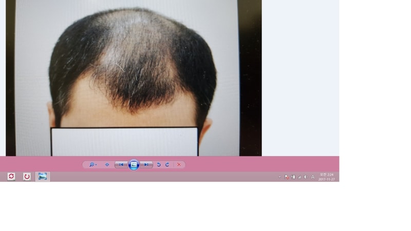 수술전22.png