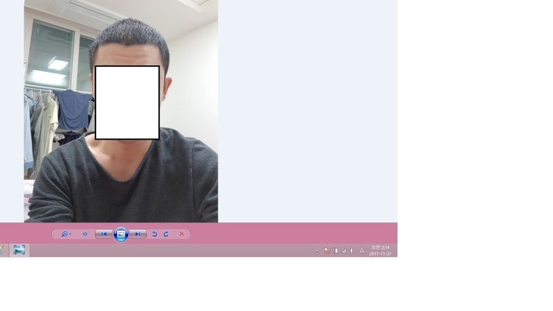수술후 4-5.png