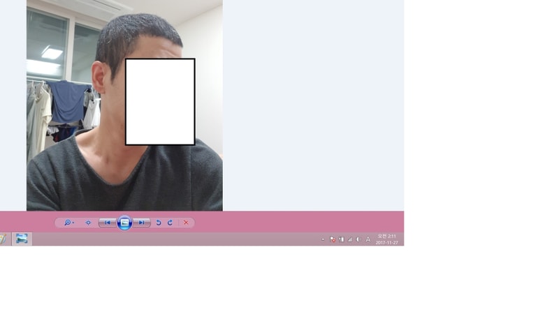 수술후 4-2.png
