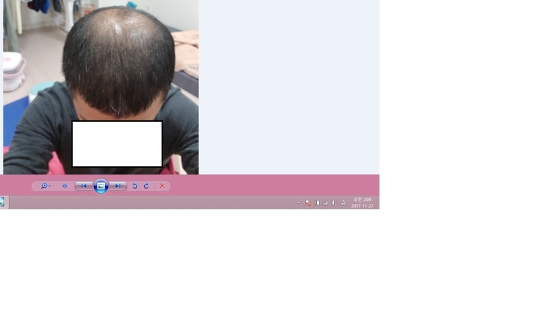 수술후 4-1.png