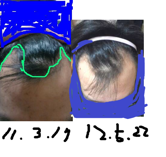 112.png