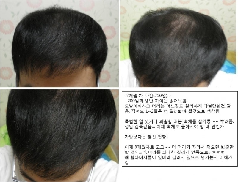 7개월.jpg