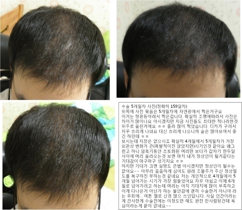포맷변환_5개월 형광등(후기).jpg