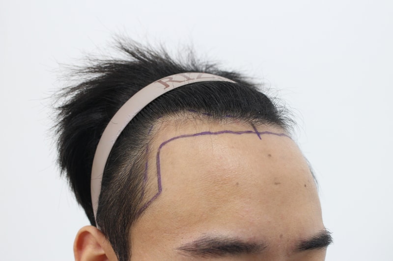왼쪽전.jpg